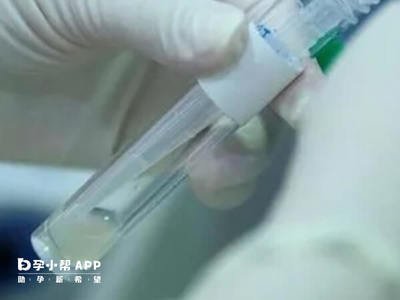 在石家庄做试管婴儿费用