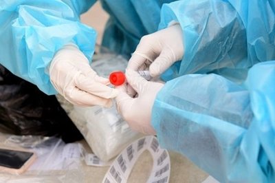 石家庄哪里可以做试管检查